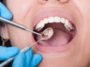 Oral Diseases Treatment in Karnal